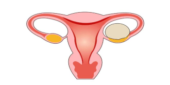 婦科凝膠定制廠家提醒：女性的這5種行為會(huì)讓卵巢受損