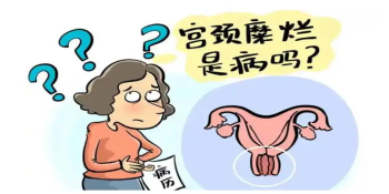 陜西醫(yī)用婦科凝膠廠家指出：女性的這些行為已誘發(fā)宮頸糜爛