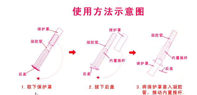 婦科凝膠使用方法示意圖 婦科凝膠使用方法示意圖