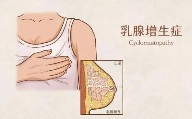 乳腺凝膠生產(chǎn)廠家